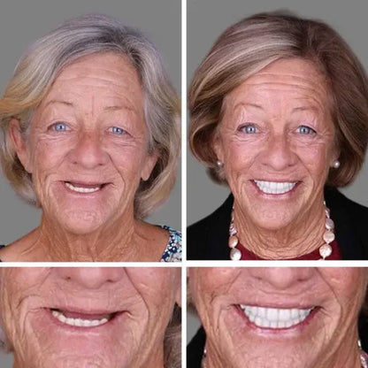 🌎Ends Today: 60% OFF! ⏰ Medical Full Denture with Strong Suctiond🦷Obtain American Dental Association (ADA) Certification