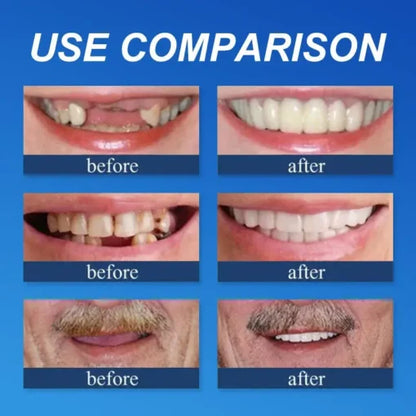 🌎Ends Today: 60% OFF! ⏰ Medical Full Denture with Strong Suctiond🦷Obtain American Dental Association (ADA) Certification