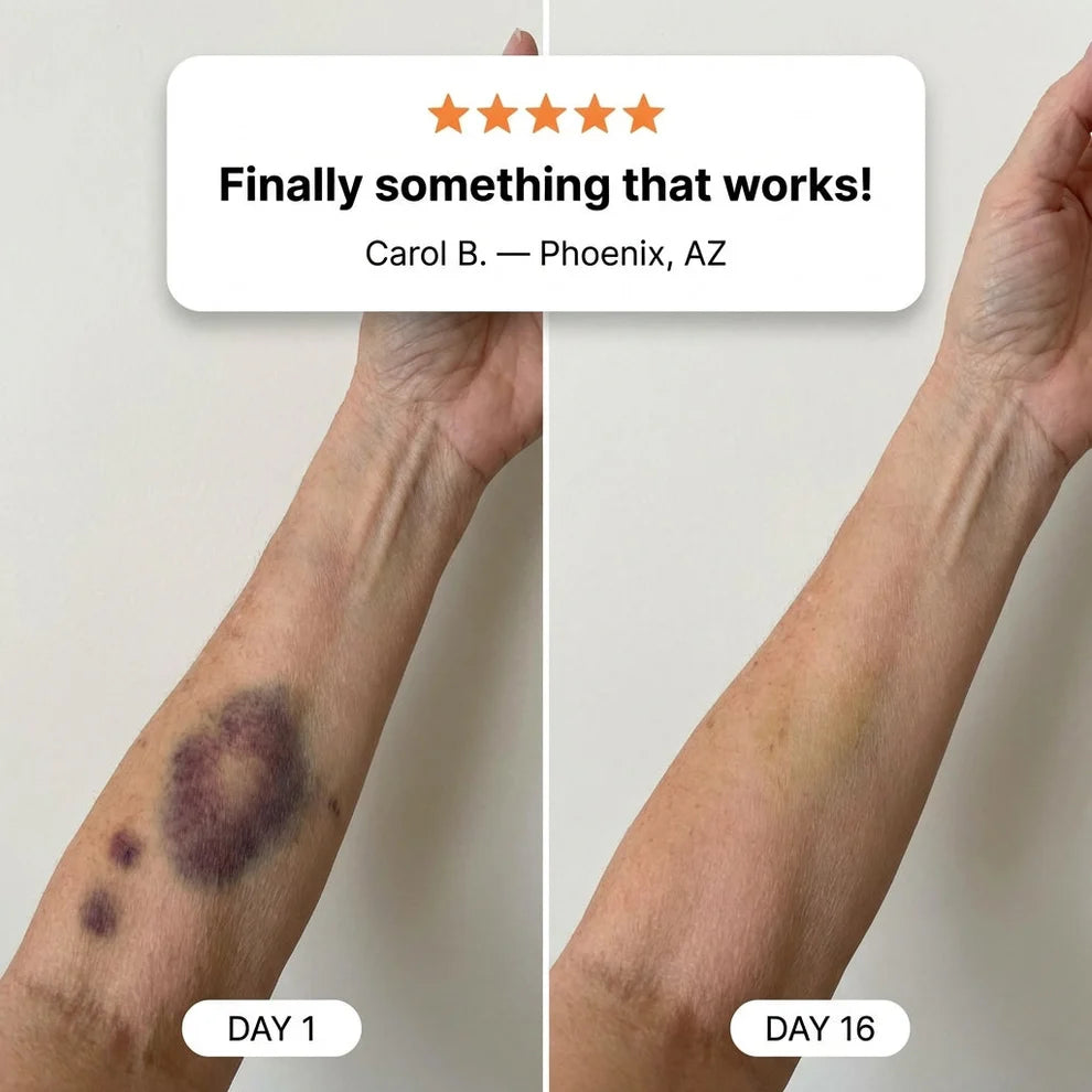 💥75K+ SOLD💕- Bruise Repair & Skin-Strengthening Cream